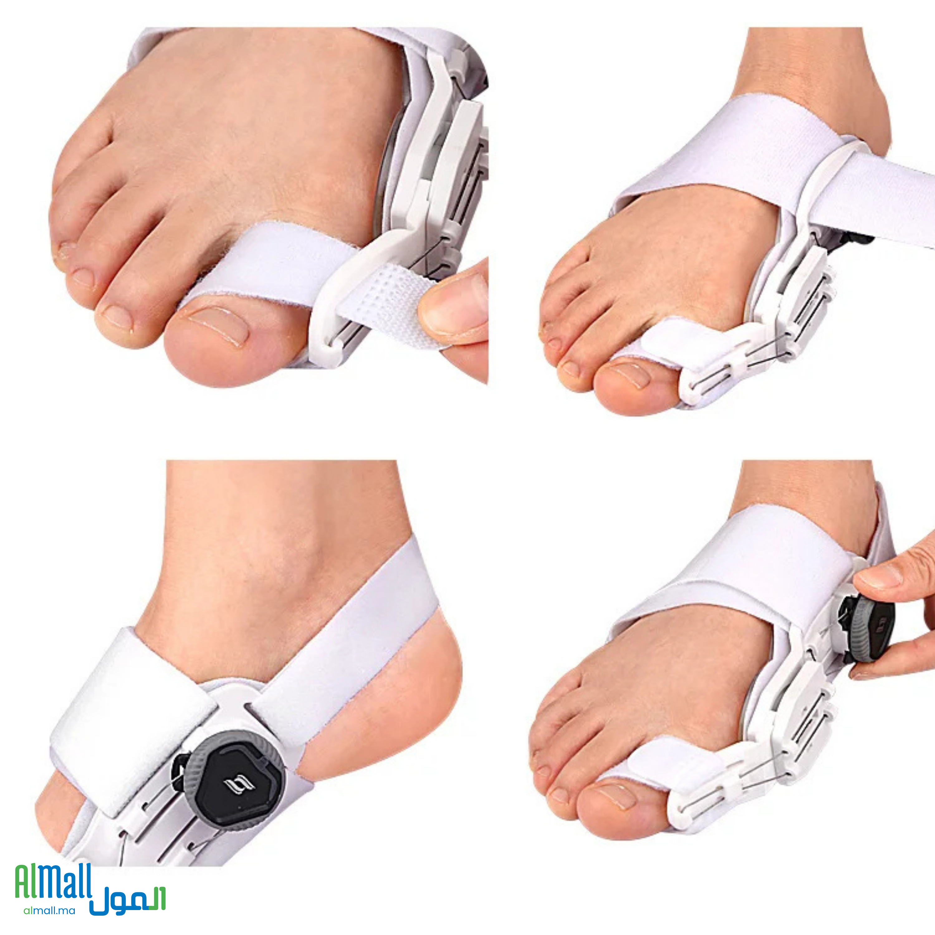 🦶 Corrigez votre hallux valgus en douceur, jour après jour