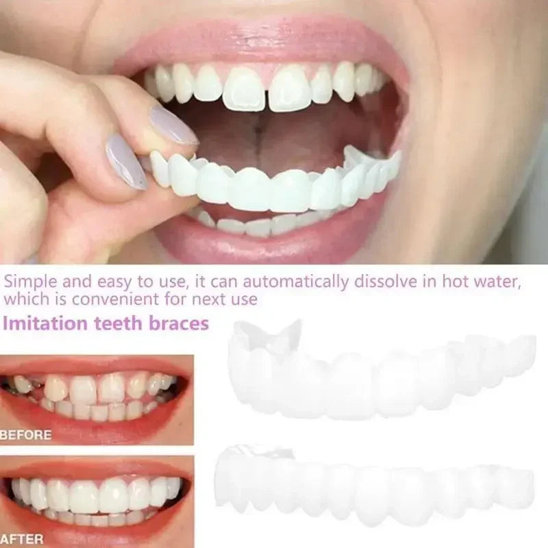 SmilePro™ — Facettes Dentaires Snap-On Ajustables