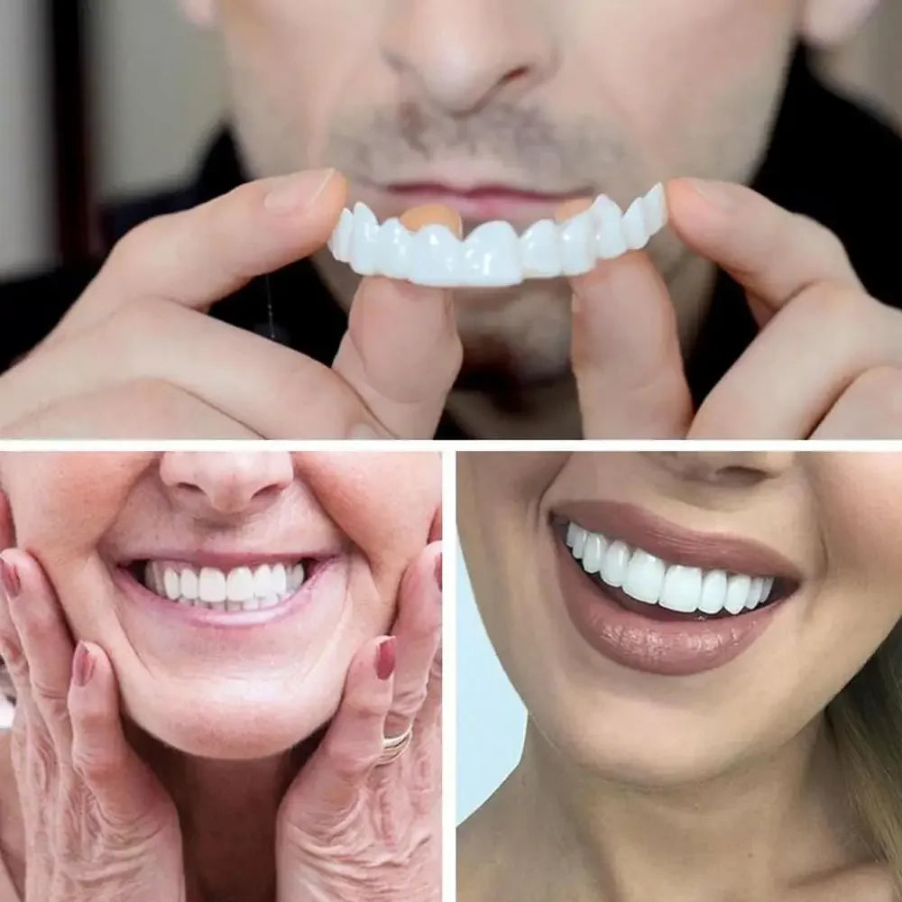 SmilePro™ — Facettes Dentaires Snap-On Ajustables