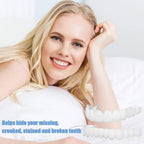 SmilePro™ — Facettes Dentaires Snap-On Ajustables