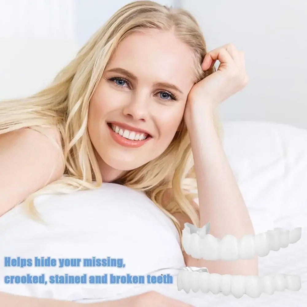 SmilePro™ — Facettes Dentaires Snap-On Ajustables