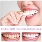 SmilePro™ — Facettes Dentaires Snap-On Ajustables