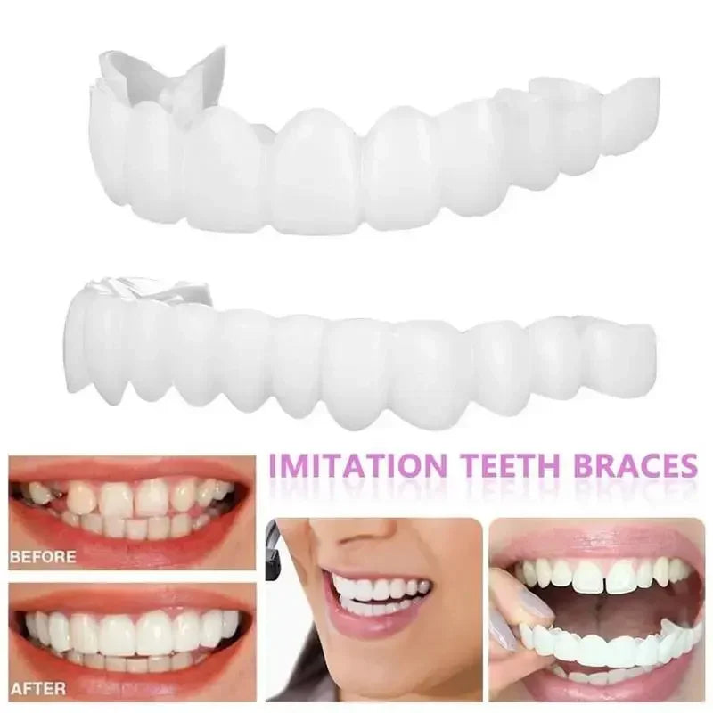SmilePro™ — Facettes Dentaires Snap-On Ajustables