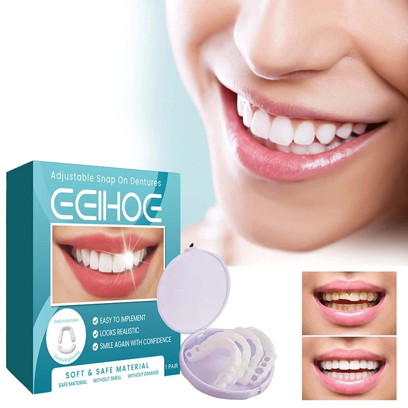 SmilePro™ — Facettes Dentaires Snap-On Ajustables