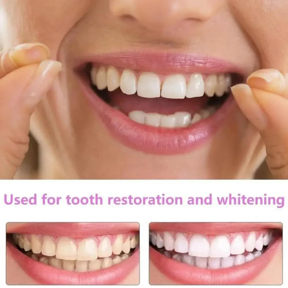 SmilePro™ — Facettes Dentaires Snap-On Ajustables